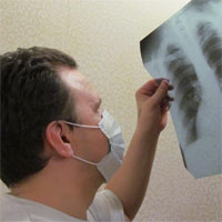 Туберкулез: палочный режим